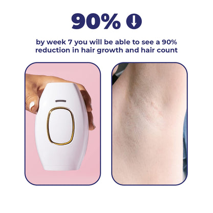 MomDaughts' Mini IPL Hair Remover