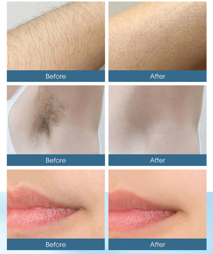 MomDaughts' IPL Hair Remover New.