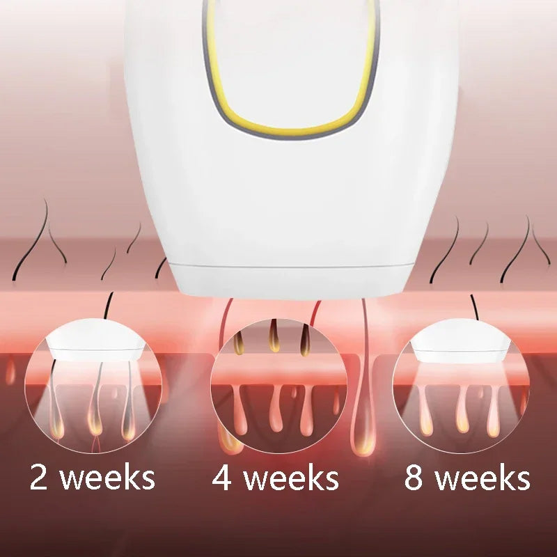 MomDaughts' IPL Hair Remover New.