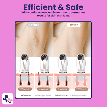 MomDaughts' Premium IPL Hair Remover with Cooling Effect.