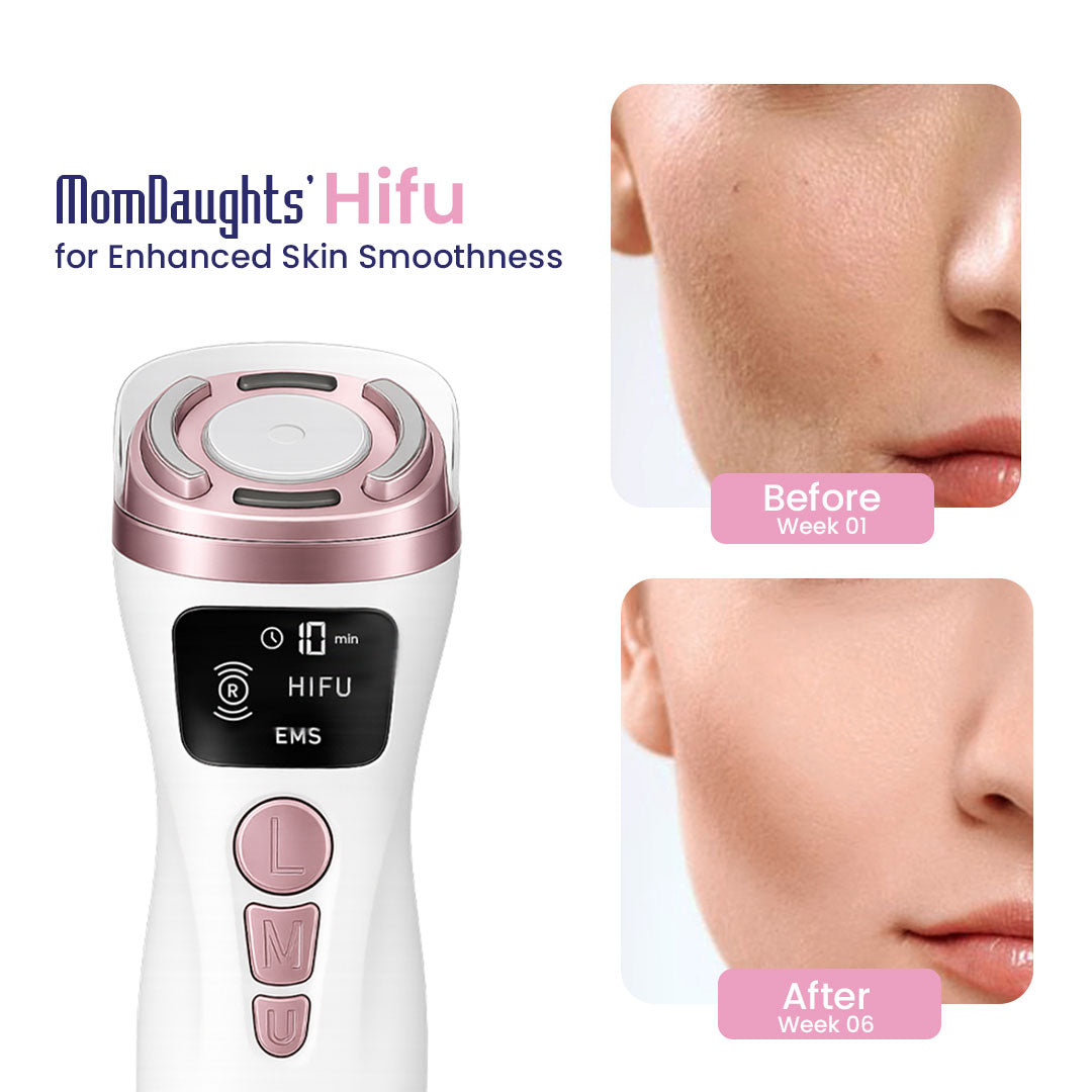 Best HIFU Machine for Face Lifting & Skin Tightening | MomDaughts